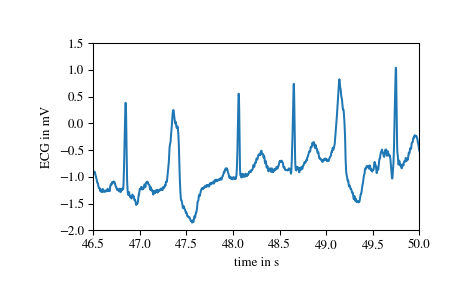 ../_images/scipy-misc-electrocardiogram-1_01_00.png