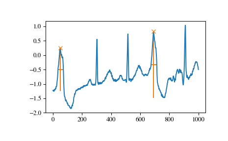 ../_images/scipy-signal-find_peaks-1_04_00.png