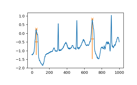 ../_images/scipy-signal-find_peaks-1_04_00.png